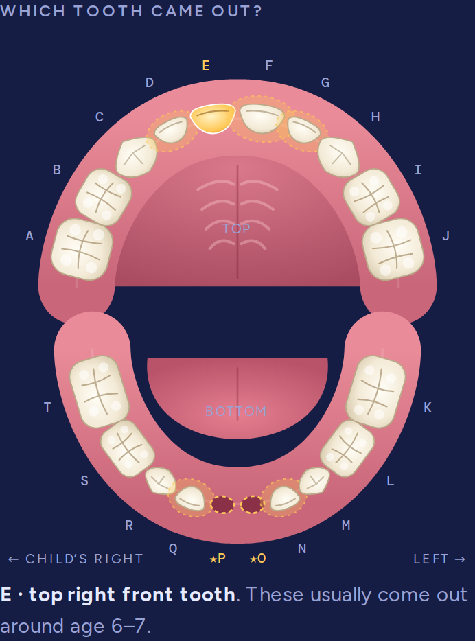 A map of all 20 baby teeth with one tooth highlighted in gold